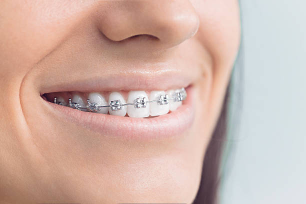 Best Teeth Whitening  in Providence Village, TX